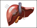 Illustration for Stern Urology